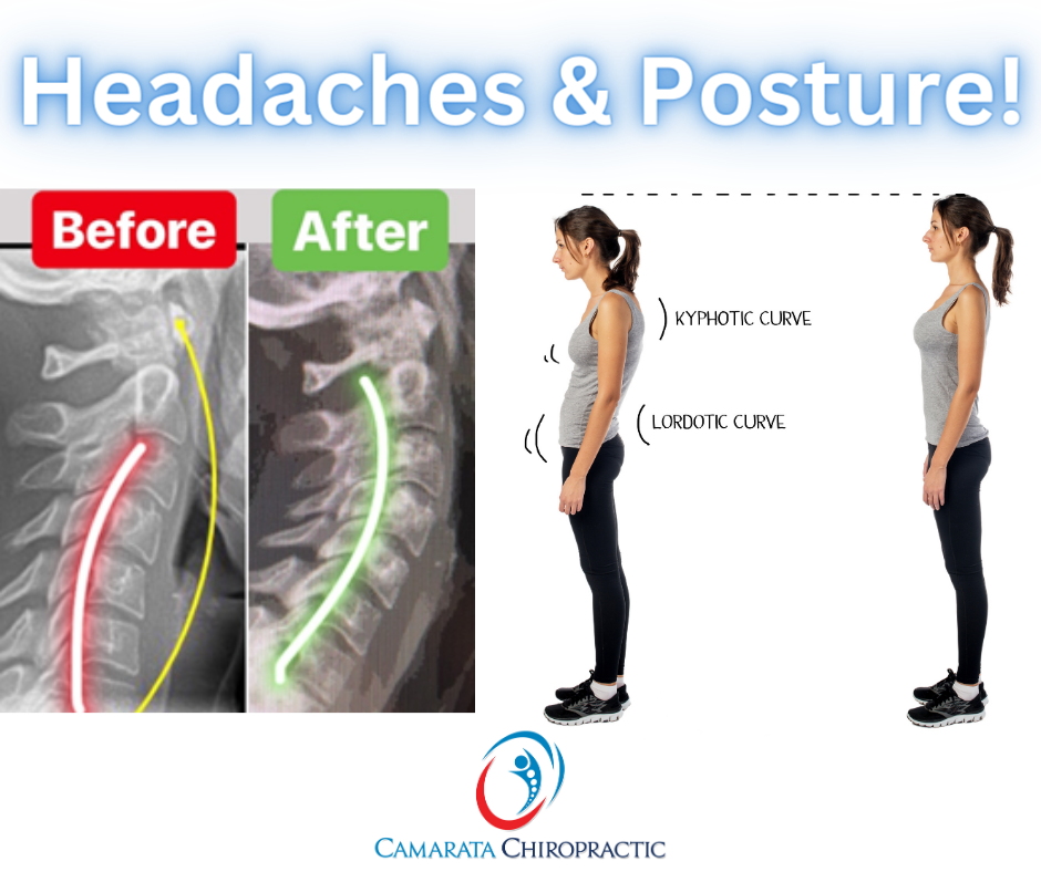 Saying Goodbye to Headaches: Unlocking Relief Through Posture and Chiropractic Care!
