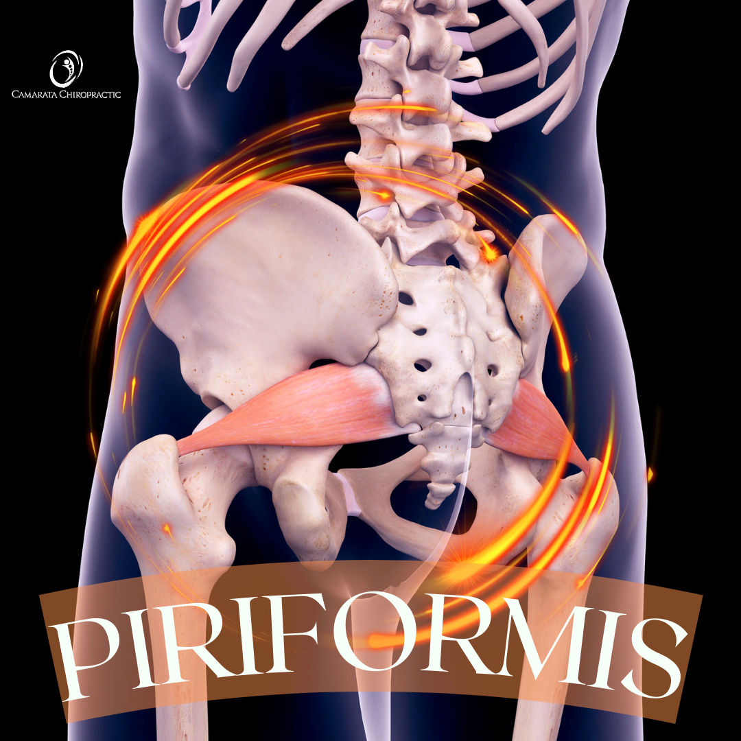 Overcoming Piriformis Syndrome: The Synergy of SoftWave Therapy and Chiropractic Care for Optimal Results
