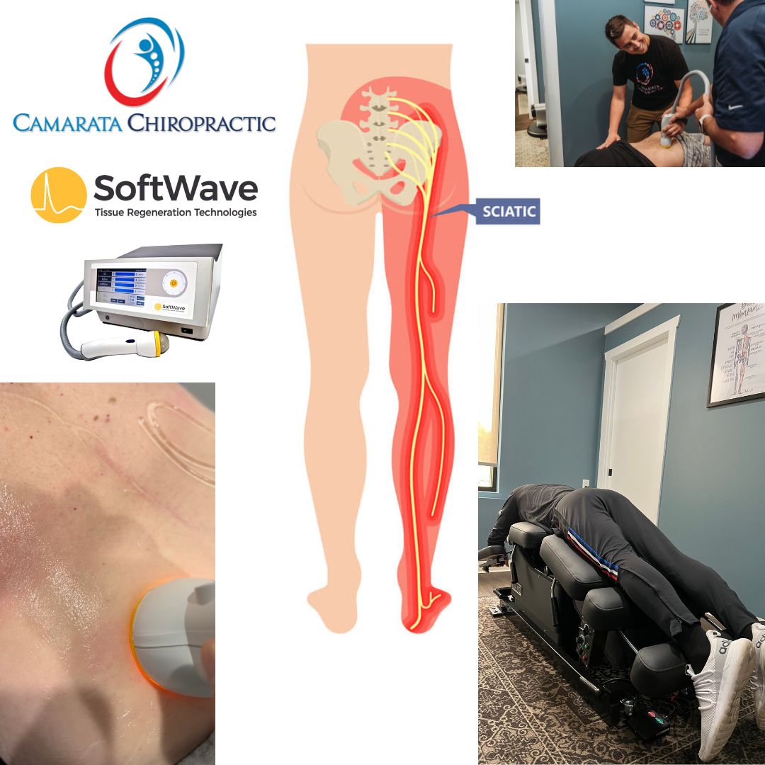 Exploring Non-Surgical Solutions in Rochester, NY for Sciatica: Find Relief at Camarata Chiropractic in North Chili, NY