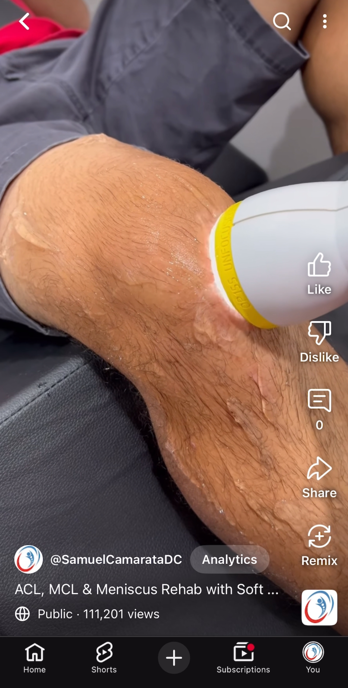ACL, MCL & Meniscus Rehab Goes Viral! What 100,000+ Views on YouTube Reveal About Knee Pain Relief with SoftWave Therapy in Chili & Rochester, NY ACL, MCL & Meniscus Rehab Goes Viral! What 100,000+ Views on YouTube Reveal About Knee Pain Relief with SoftWave Therapy in Chili & Rochester, NY
