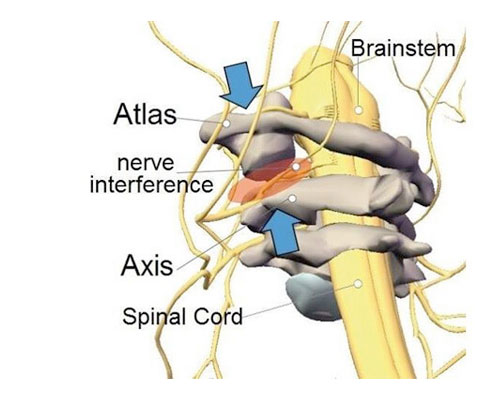 The Intricate Dance of the Upper Spine: Atlas, Axis, and Neural Pathways
