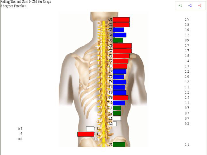 Can Chiropractic Help with Allergies?